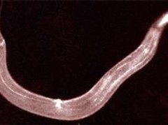 Нематода C.Elegans, фото с сайта ecplanet.com Нематода C.Elegans, фото с сайта ecplanet.com